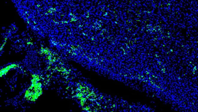 Menschliche Herzzellen (grün) im Herzen des Hybrid-Embryos (Bild: Salk Institute)