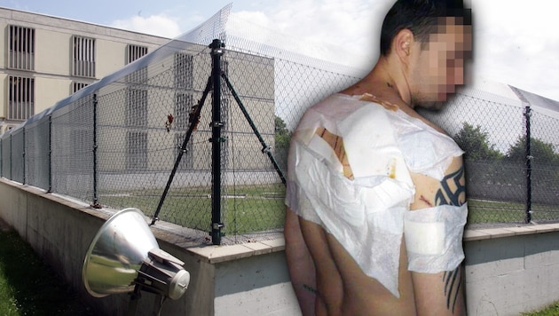 Schnittwunden am ganzen Rücken trug Häftling Dominik P. bei der Attacke in der Haftanstalt davon. (Bild: ANDI SCHIEL, Privat)