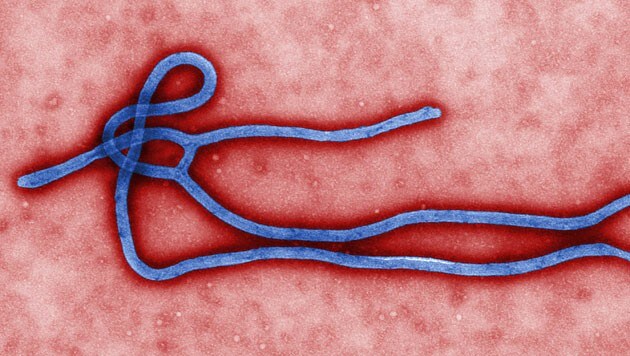 Elektronenmikroskopische Aufnahme des Ebola-Erregers (Bild: CDC/Cynthia Goldsmith)
