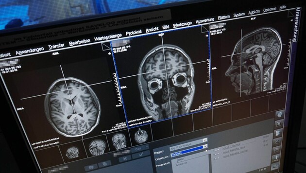 MRT-Aufnahme eines menschlichen Gehirns (Bild: Universität Jena/Jan-Peter Kasper)
