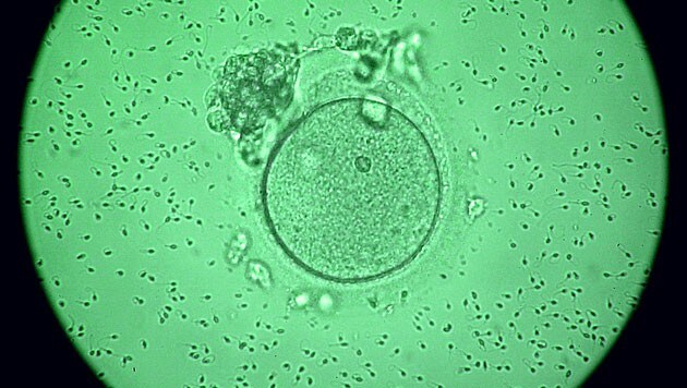 Mikroskopische Aufnahme einer von Spermien umgebenen menschlichen Eizelle (Bild: APA/dpa/Jan-Peter Kasper)