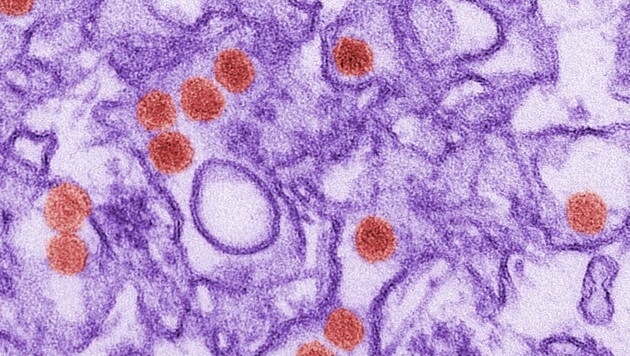Elektronenmikroskopische Aufnahme von Zika-Viren (rot) (Bild: CDC)