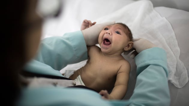 Ein drei Monate altes Baby mit Mikrozephalie, das durch das Zika-Virus ausgelöst wird (Bild: Associated Press)