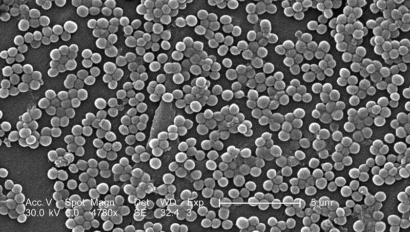 Der Erreger MRSA unter dem Elektronenmikroskop (Bild: CDC/Janice Carr/Deepak Mandhalapu, M.H.S.)