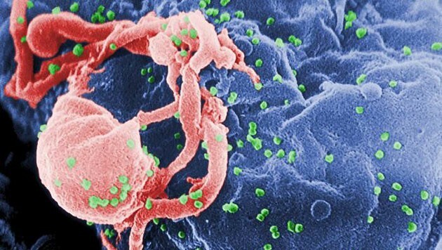 Ein HI-Virus auf einem Lymphozyten (Bild: CDC/C. Goldsmith)