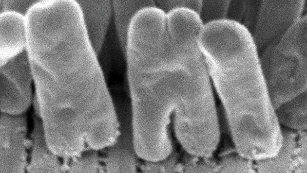 Mikroskopische Aufnahme des Stäbchenbakteriums (Bild: Nikolaus Leisch, Nature Microbiology)
