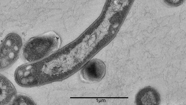So sieht der Tuberkulose-Erreger unter dem Mikroskop aus. (Bild: APA/rki/Rki/Gudrun Holland)