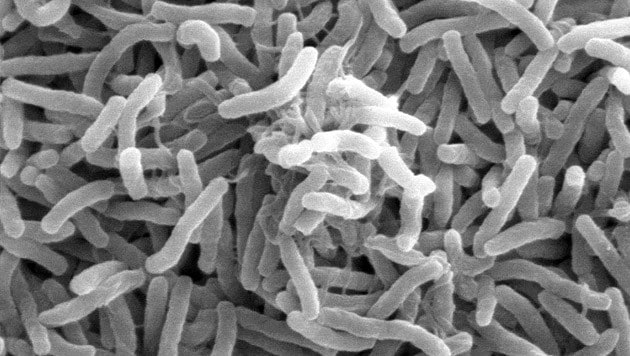 Das Cholera-Bakterium (Bild: Ronald Taylor, Tom Kirn, Louisa Howard)