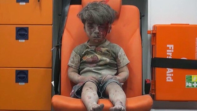 Ein verletztes Kind in Aleppo: Ein Bild, das berührt. (Bild: AP)