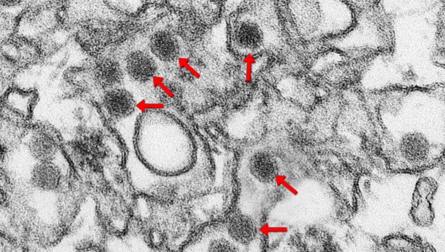 Elektronenmikroskopische Aufnahme von Zika-Viren (rote Pfeile) (Bild: CDC/Cynthia Goldsmith)