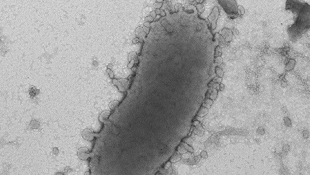 Elektronenmikroskopische Aufnahme eines Alistipes-Bakteriums (Bild: BioMedCentral/Anne Pfleiderer et al.)