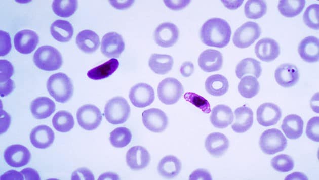Mikroskopische Aufnahme des Malaria Erregers Plasmodium falciparum (Bild: CDC/Dr. Mae Melvin)