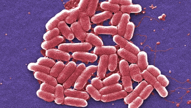 Eine elektronenmikroskopische Aufnahme von Escherichia-coli-Bakterien, von denen manche Stämme pathogen sind (Bild: CDC/Janice Carr)