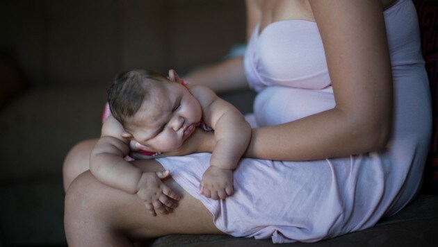 Ein Baby in Brasilien, das mit Mikrozephalie geboren wurde (Bild: Associated Press)