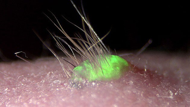 Fluoreszenzmarker lassen die "Embryoid bodies" hellgrün leuchten. (Bild: RIKEN/Takashi Tsuji)