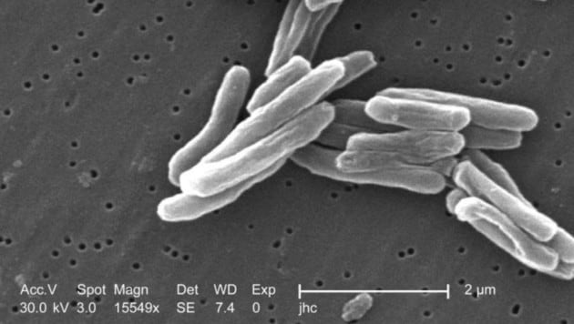 So sieht ein Tuberkulose-Erreger unter dem Mikroskop aus. (Bild: Elektromikroskopische Aufnahme)