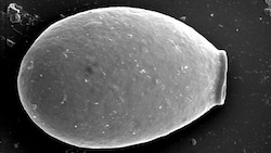 Elektronenmikroskopische Aufnahme von Nebela gimlii (Bild: Universität Neuenburg)