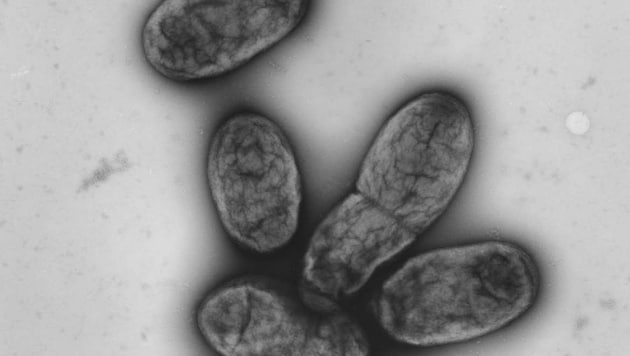 Elektronenmikroskopische Aufnahme des Pestbakteriums Yersinia pestis (Bild: APA/Robert-Koch-Institut)