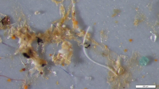 Mikroskopische Aufnahme von im Meer schwimmenden, winzigen Kunststoffteilchen (Bild: Alfred-Wegener-Institut/Svenja Mintenig, Ivo Int-Veen)