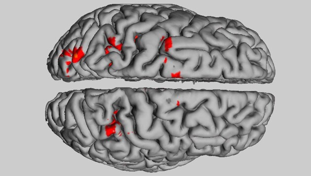 Die Areale (rot markiert) des "Weihnachts-Netzwerks" im Gehirn (Bild: BMJ/Anders Hougaard et al.)