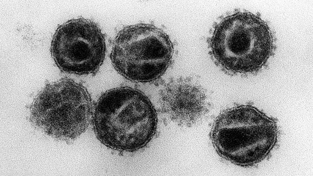 HI-Viren unter dem Elektronenmikroskop (Bild: EPA/STR)