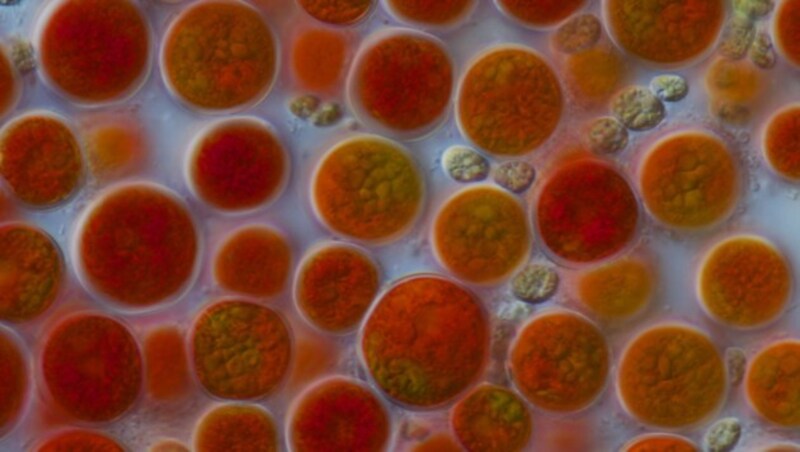 Die Algenart Haematococcus pluvialis unter dem Mikroskop (Bild: Eckhard Völcker (Creative Commons))
