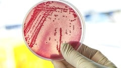 Grund für die Aufregung ist die schnelle Ausbreitung der Kolibakterien, bei denen kein Antibiotikum anschlägt (Symbolbild). (Bild: thinkstockphotos.de)