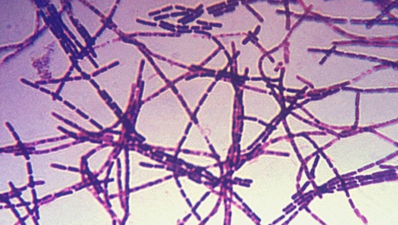 Mikroskopische Aufnahme des Anthrax-Erregers (Bild: Centers for Disease Control and Prevention)