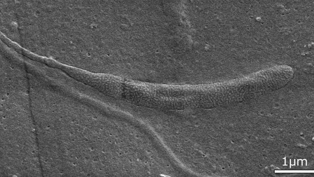 Elektronenmikroskopische Teilaufnahme eines Spermiums (Bild: Department of Palaeobiology, Swedish Museum of Natural History)
