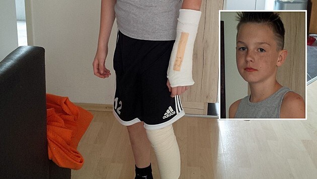 Hendrik (12) trug Verletzungen an Arm und Bein davon. (Bild: "Krone")