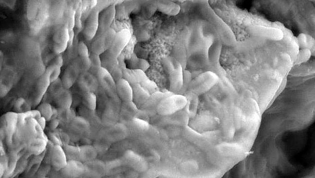 Mikroskopische Aufnahme der an rote Blutzellen erinnernden Strukturen (Bild: Imperial College London)