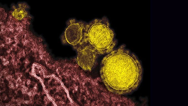 Elektronenmikroskopische Aufnahme des MERS-Coronavirus (gelb) (Bild: NIAID-RML)