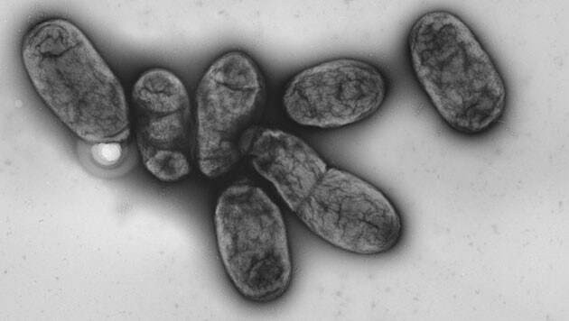 Elektronenmikroskopische Aufnahme des Pestbakteriums Yersinia pestis (Bild: Robert-Koch-Institut)