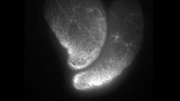 Mikroskopische Aufnahme zweier sogenannter "stabiler Bläschen-Zellen" (Bild: © Verena Ruprecht und Carl-Philipp Heisenberg)