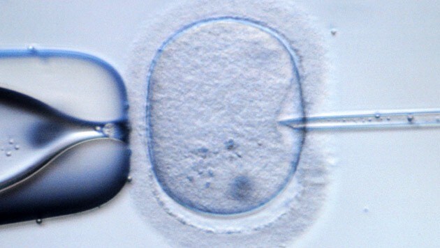Mikroskopische Aufnahme einer menschlichen Eizelle (Bild: APA/dpa/Ralf Hirschberger)