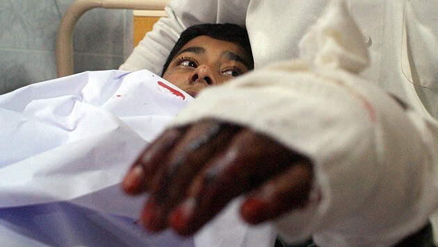 Dieser Bursche überlebte, doch mindestens 132 Mitschüler wurden bei der Taliban-Attacke ermordet. (Bild: AFP)