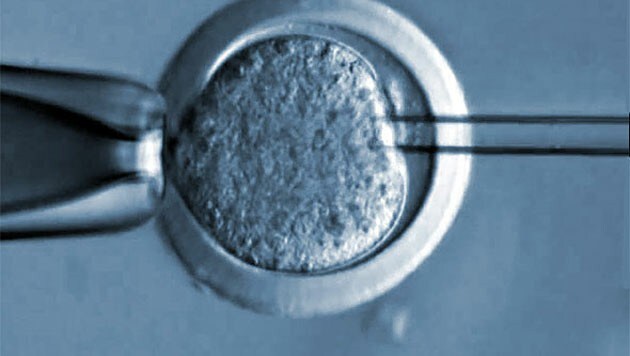 Ein somatischer Zellkerntransfer unter dem Mikroskop (Bild: HHMI)
