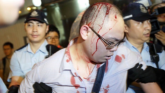Ein verletzter Demonstrant wird von Sicherheitskräften eskortiert. (Bild: AP)
