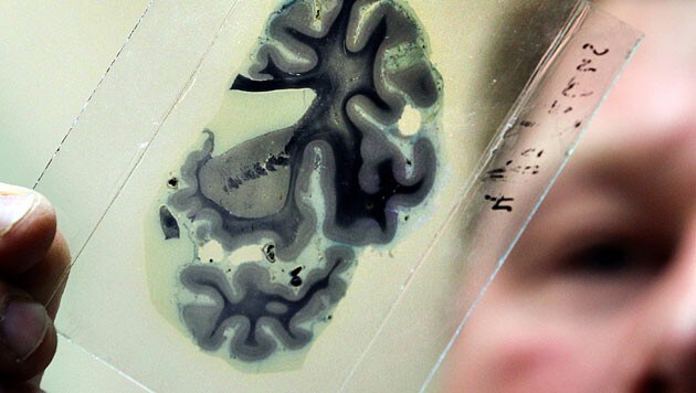 Mikrotomschnitt durch Gehirnlappen (Bild: EPA/Bernd Wuestneck/picturedesk.com)
