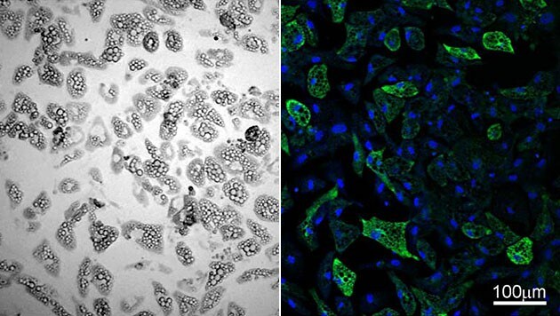 Braune Fettzellen (rechts fluoreszierend) geben verstärkt Energie in Form von Wärme ab. (Bild: © TU Graz)