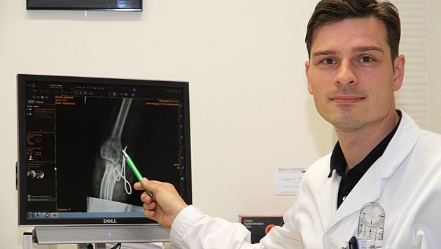 Chirurg Manfred Schmidt zeigt am Röntgenbild, wie der Unterarm gerettet wurde. (Bild: Christoph Gantner)