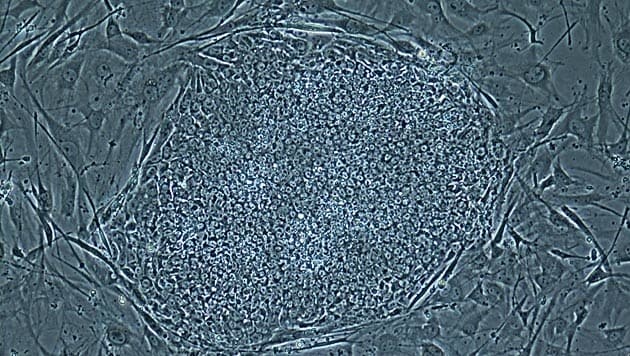 So sehen geklonte menschliche Stammzellen aus. (Bild: Oregon Health & Science University)