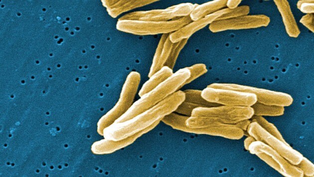 Elektronenmikroskopische Aufnahme des Tuberkulose-Erregers. (Bild: CDC/Janice Carr)