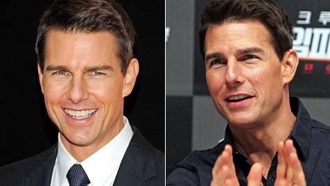 Mimik Impossible Tom Cruise Unter Schwerem Botox Verdacht Krone At